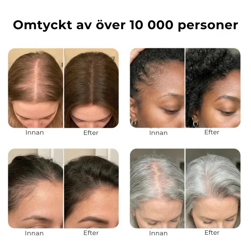 Hairlux® | Koreas mest populära hårväxtserum - Bild 2