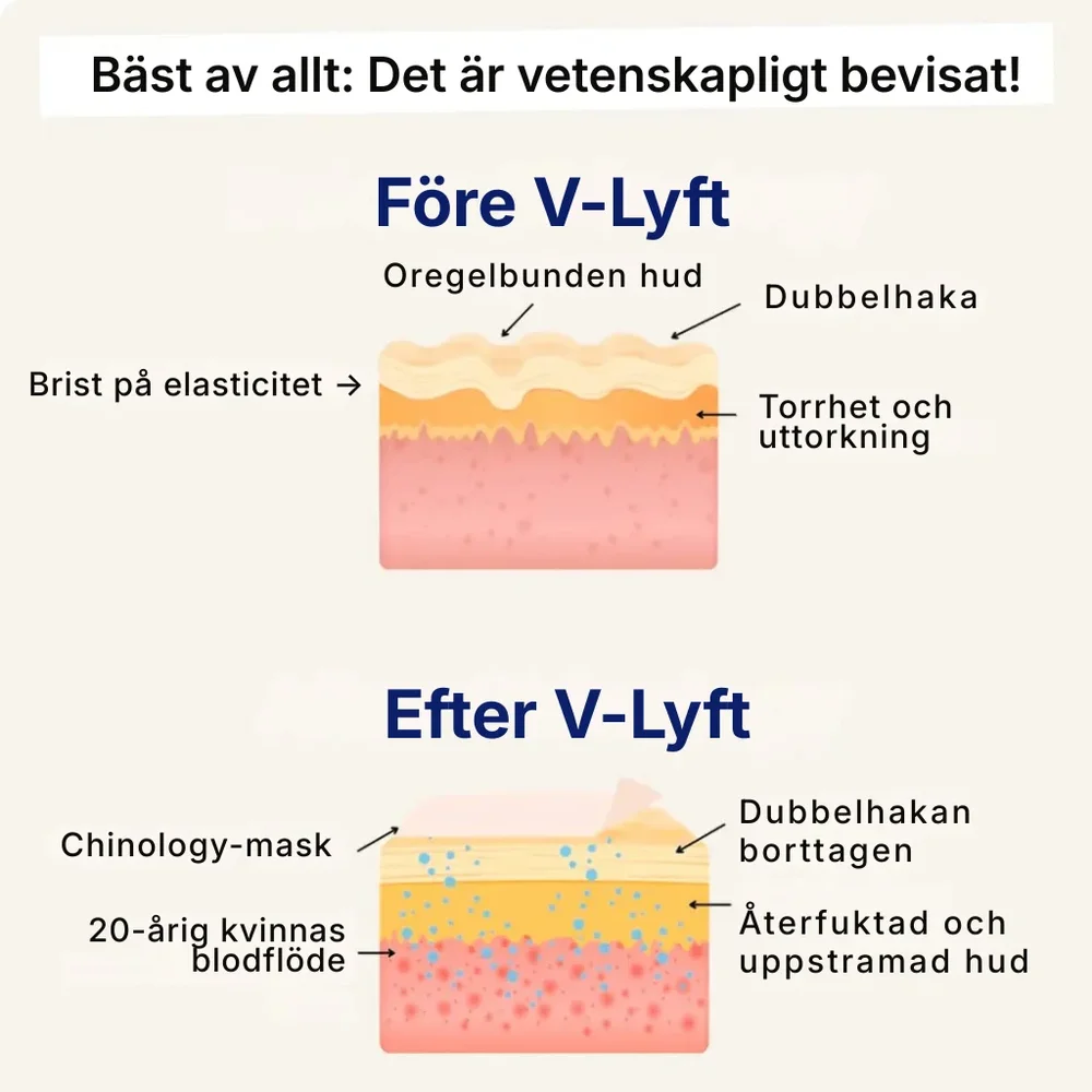 V-Lyft® | Känn dig självsäker igen med en naturligt lyft käklinje på 3 veckor - Bild 3