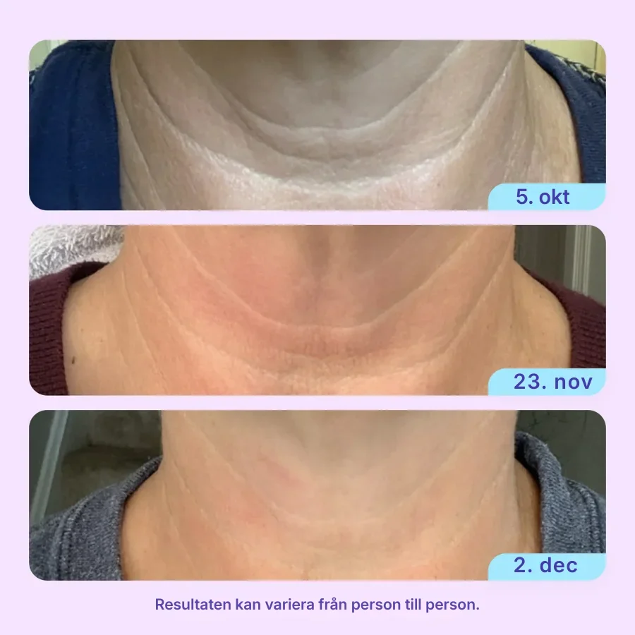 Firmora® | Sculpt & Lift halskräm - Bild 2