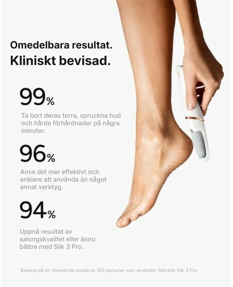 Silkvella® Elektrisk fotfil | släta och mjuka fötter hemma på några minuter - Bild 3