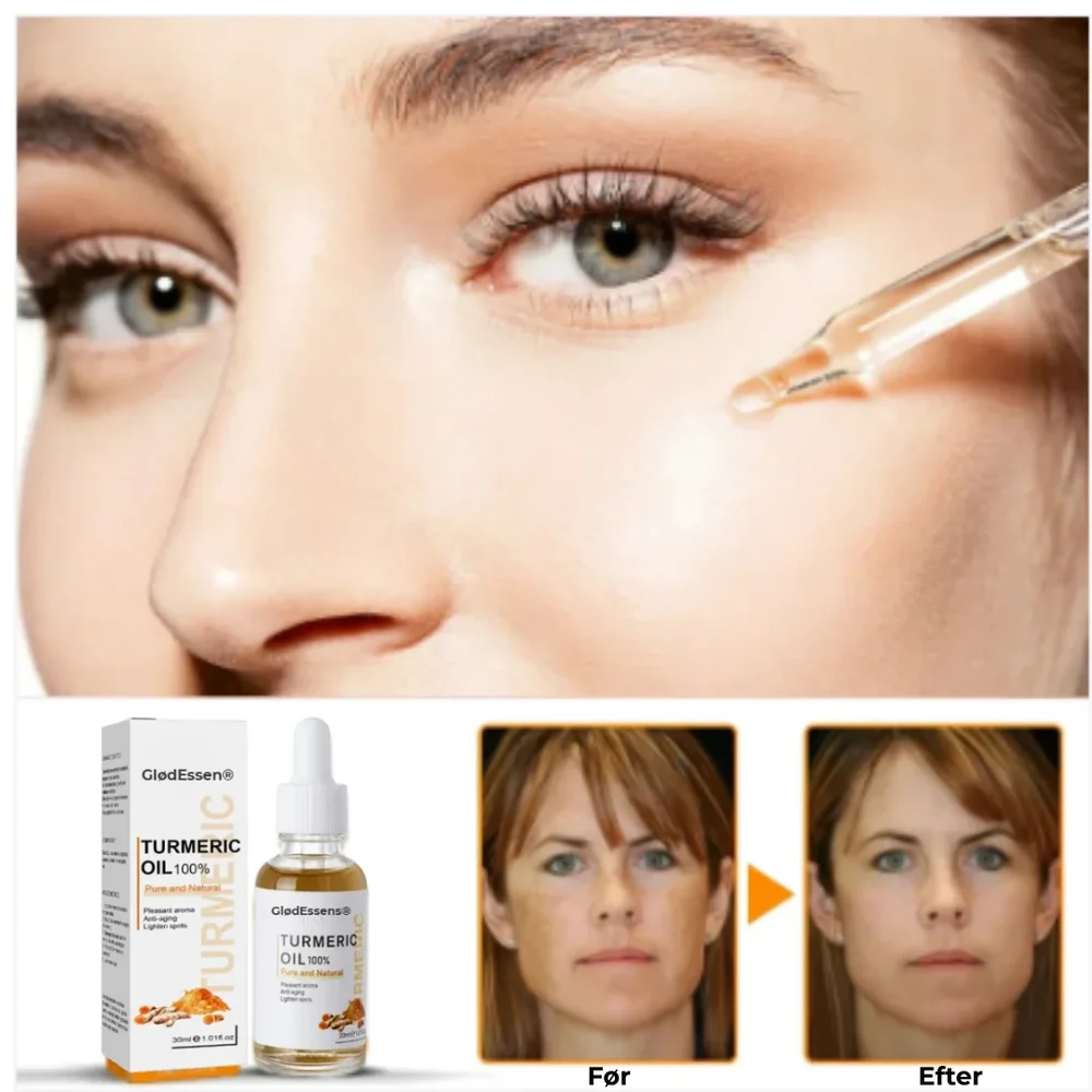GlødEssens® Serum mot Mörka Fläckar - Bild 2