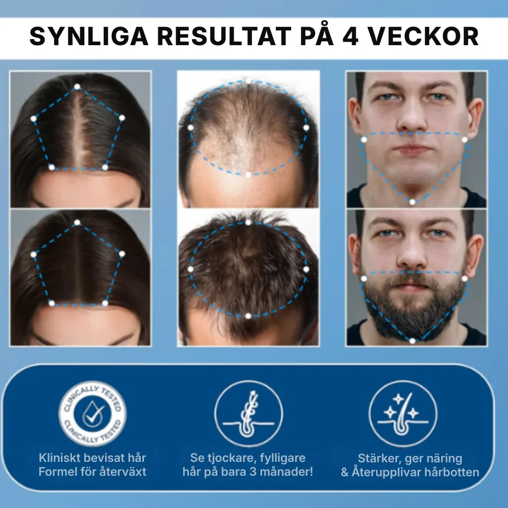HairVital® | Roll-on-serum för hårväxt - Bild 2