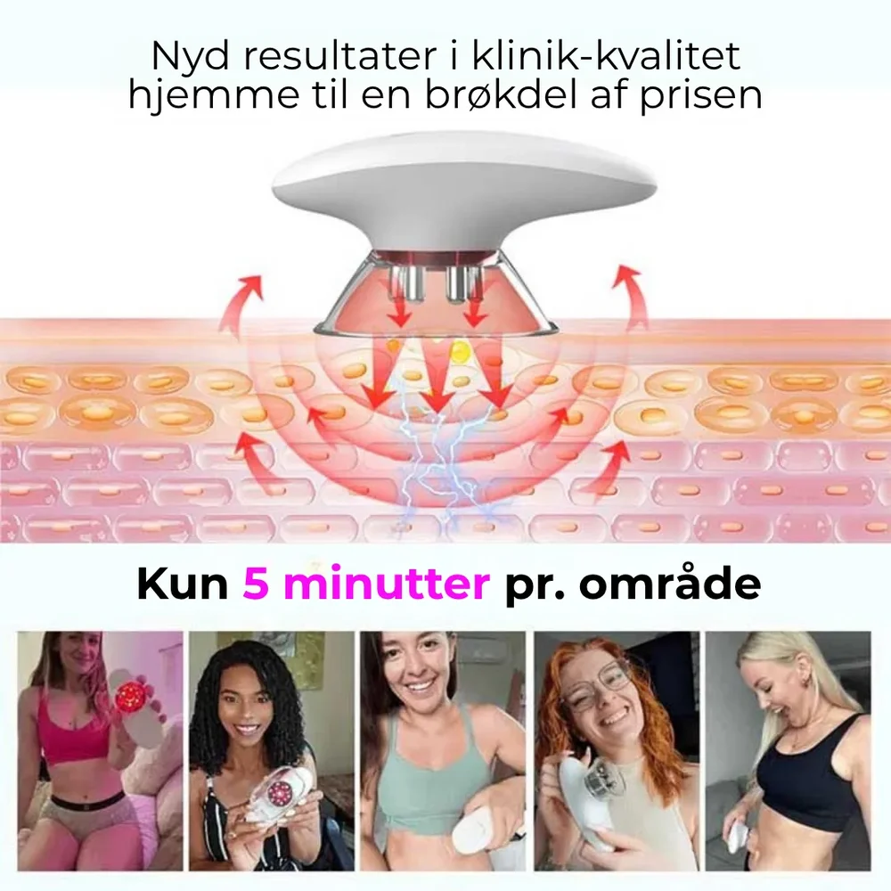 StramLy® | ✨ Förvandla din hud på bara 15 minuter om dagen – för synligt slätare, fastare och mer självsäker hud! - Bild 3