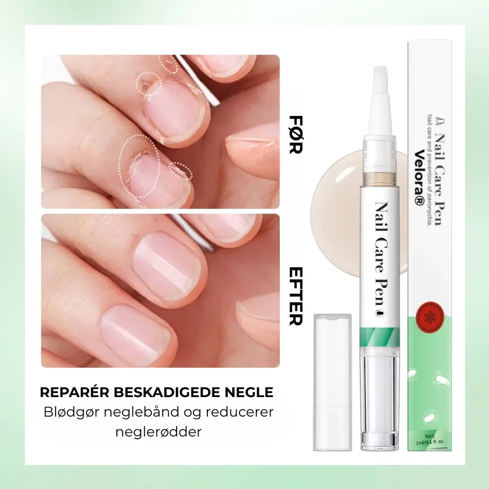 Velora® Nagelskydd | Den naturliga lösningen för starka, friska och svampfria naglar! - Bild 2