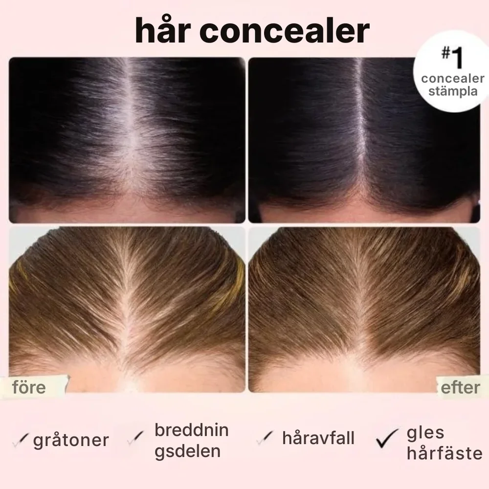 Folix® hårtäckare - Bild 3