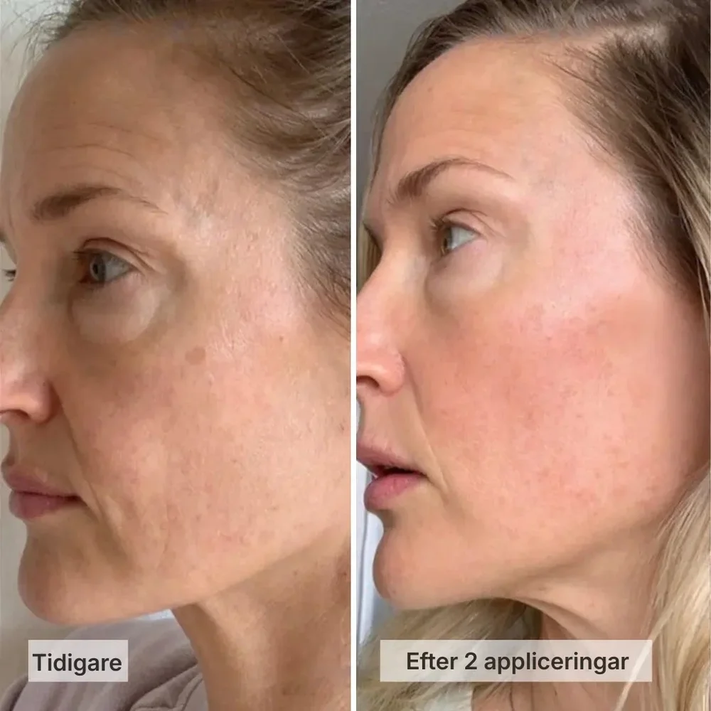 Collira® | Kollagenmask för fylligare, mjukare och mer strålande hud - Bild 2