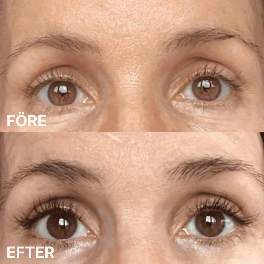 Plumele® Korean Eyelash Serum | längre, fylligare och starkare fransar - Bild 3