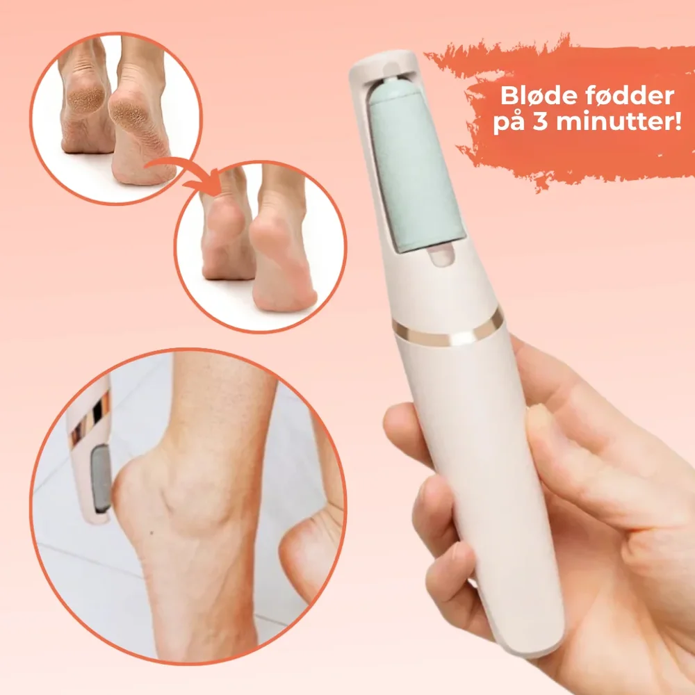 SilkSteps® | Omedelbar borttagning av hård hud för babymjuka fötter - Bild 1