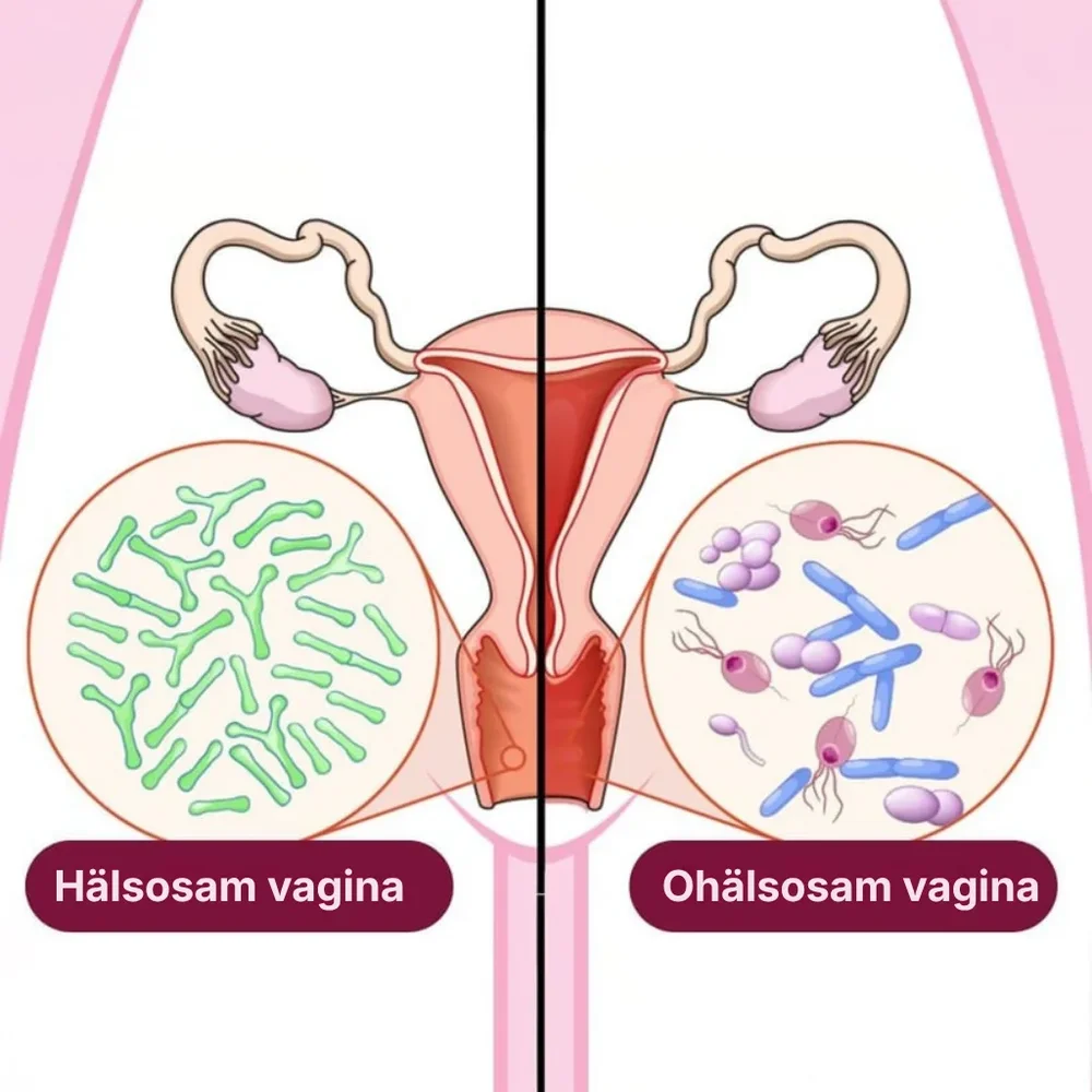 Floriva® | Tar bort obehaglig vaginal lukt och återställer din naturliga friskhet - Bild 2