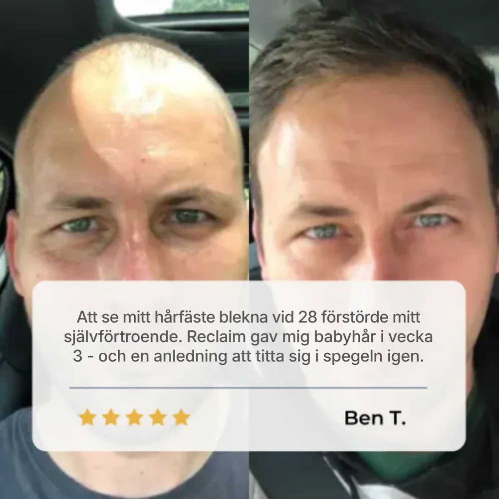 HairVital® | Roll-on-serum för hårväxt - Bild 3