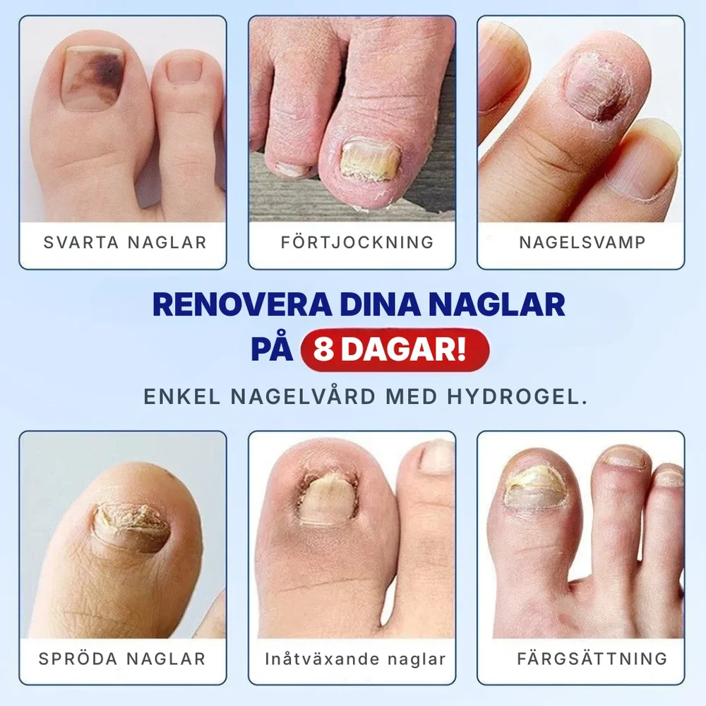 KlarNagel® | Lappar för nagelreparation - Bild 2