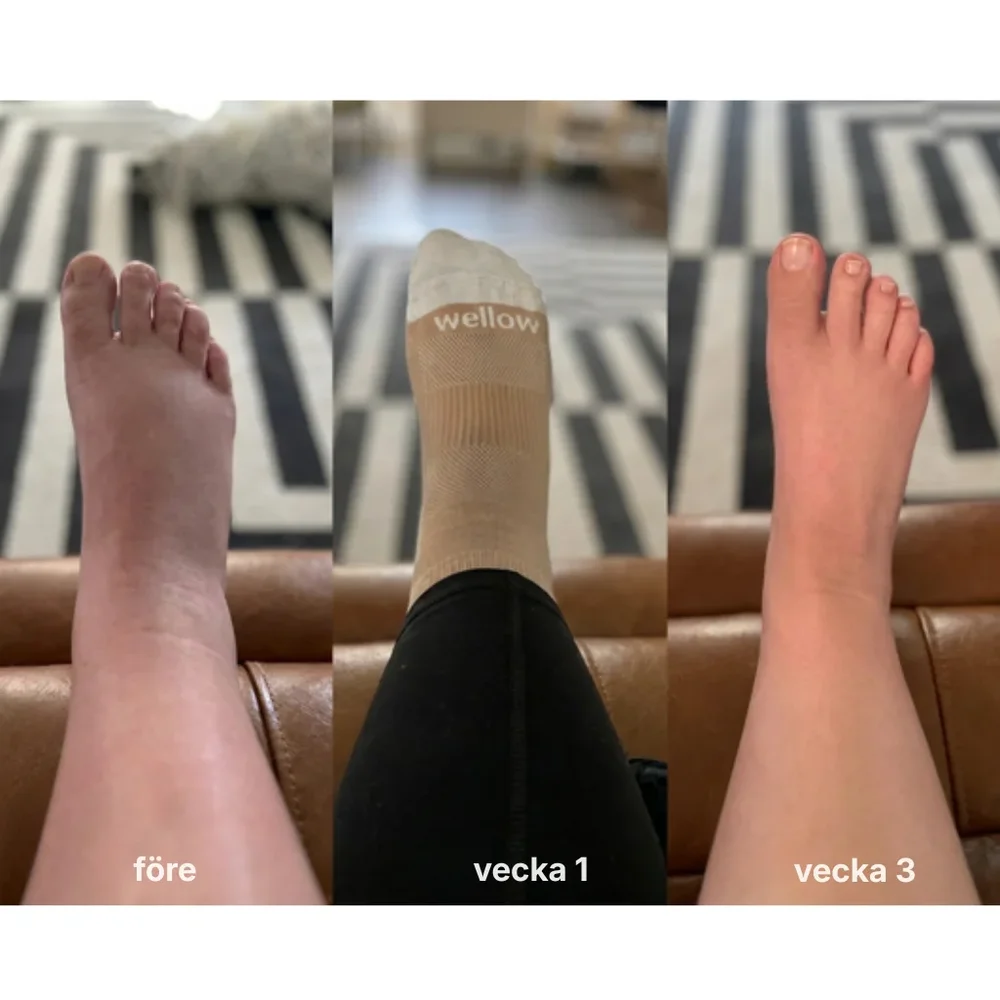 Fluvora® | Liposomala droppar för lymfdränering - Bild 3