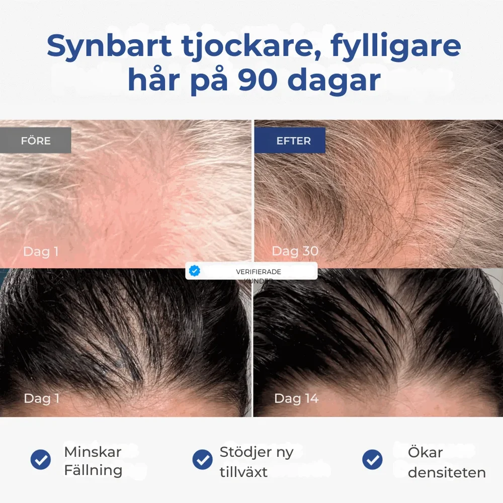 Capilux® | GHK-Cu Kopparpeptidserum | Mindre synligt håravfall & fylligare hår över tid - Bild 2