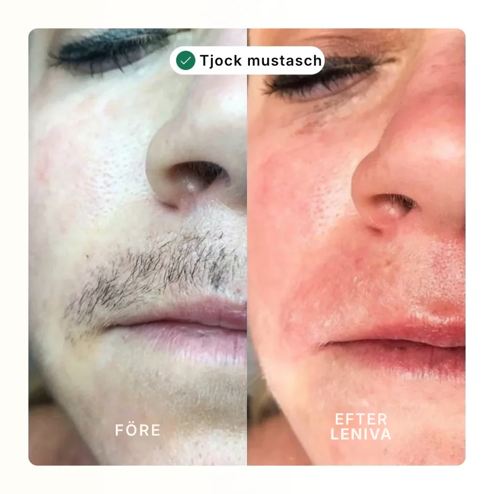 Leniva® | Hårborttagningskräm för ansiktet och lugnande serum - Bild 3