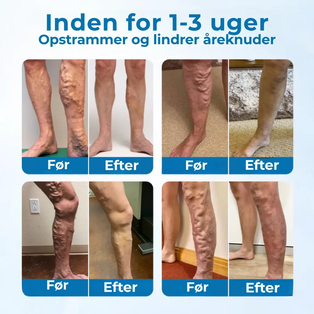 CircuClear® | Ta kontrollen över dina ben tillbaka – synlig lindring på bara 1 vecka - Bild 2