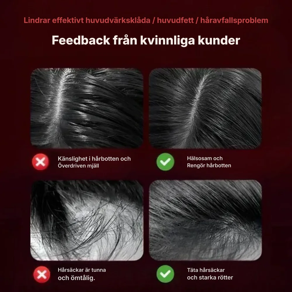Scyn® | Smart hårbottenmassager - Bild 2