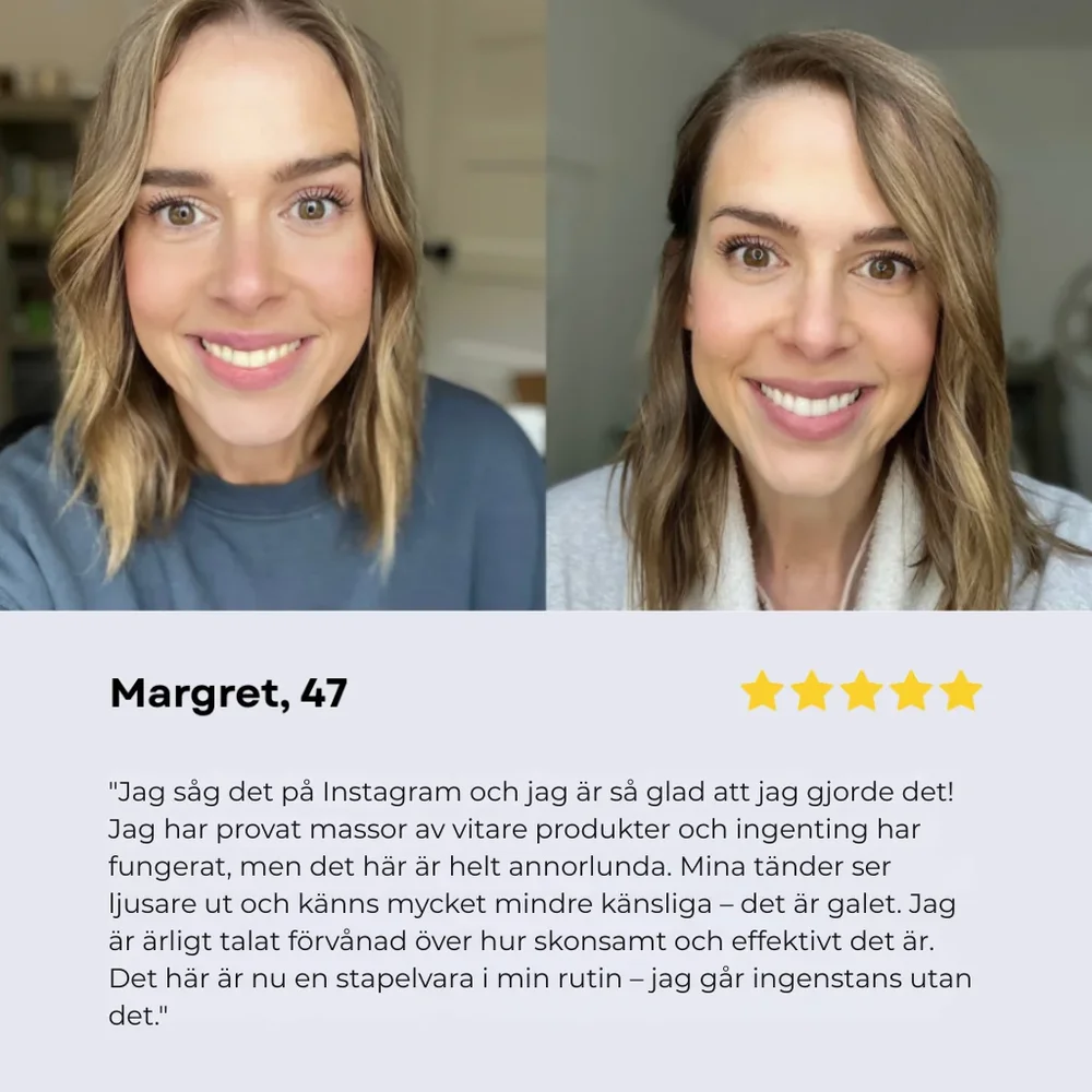 Oralux® | Tandkräm med niacinamid för vitare tänder - Bild 2