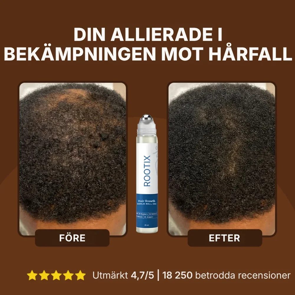 Rootix® | Rosmarin-roll-on-serum för hårväxt - Bild 2