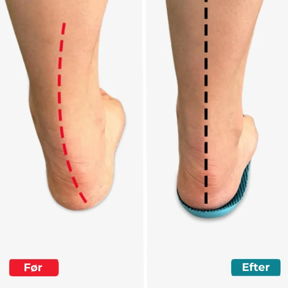 FodLind® | Trött på fotsmärtor? Upplev de revolutionerande FodLind® inläggssulorna som ger lindring utan medicin! - Bild 3
