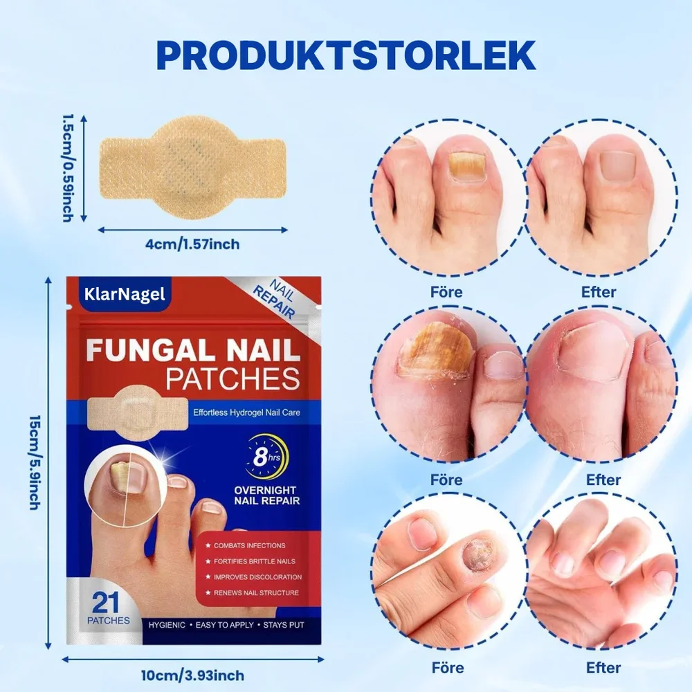 KlarNagel® | Lappar för nagelreparation - Bild 3