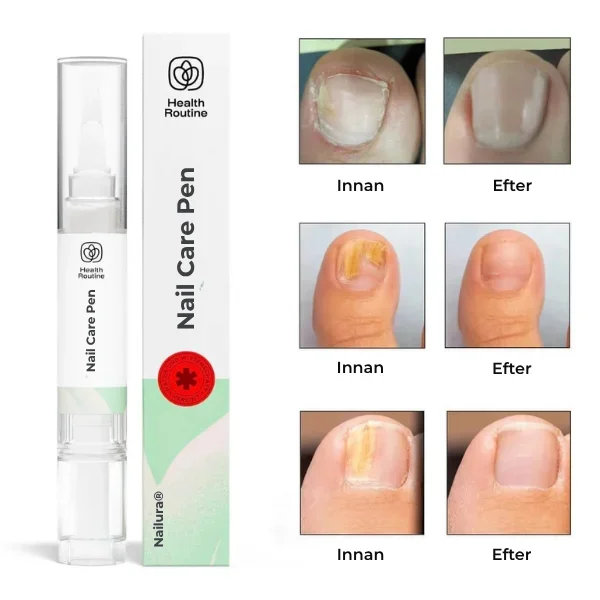 Nailura® | Nagelvårdspenna - Bild 3