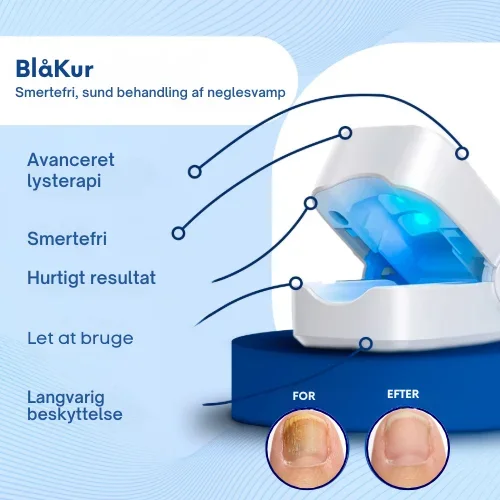BlåKur | Smärtfri och effektiv behandling av svamp och kritaktiga naglar - Bild 1