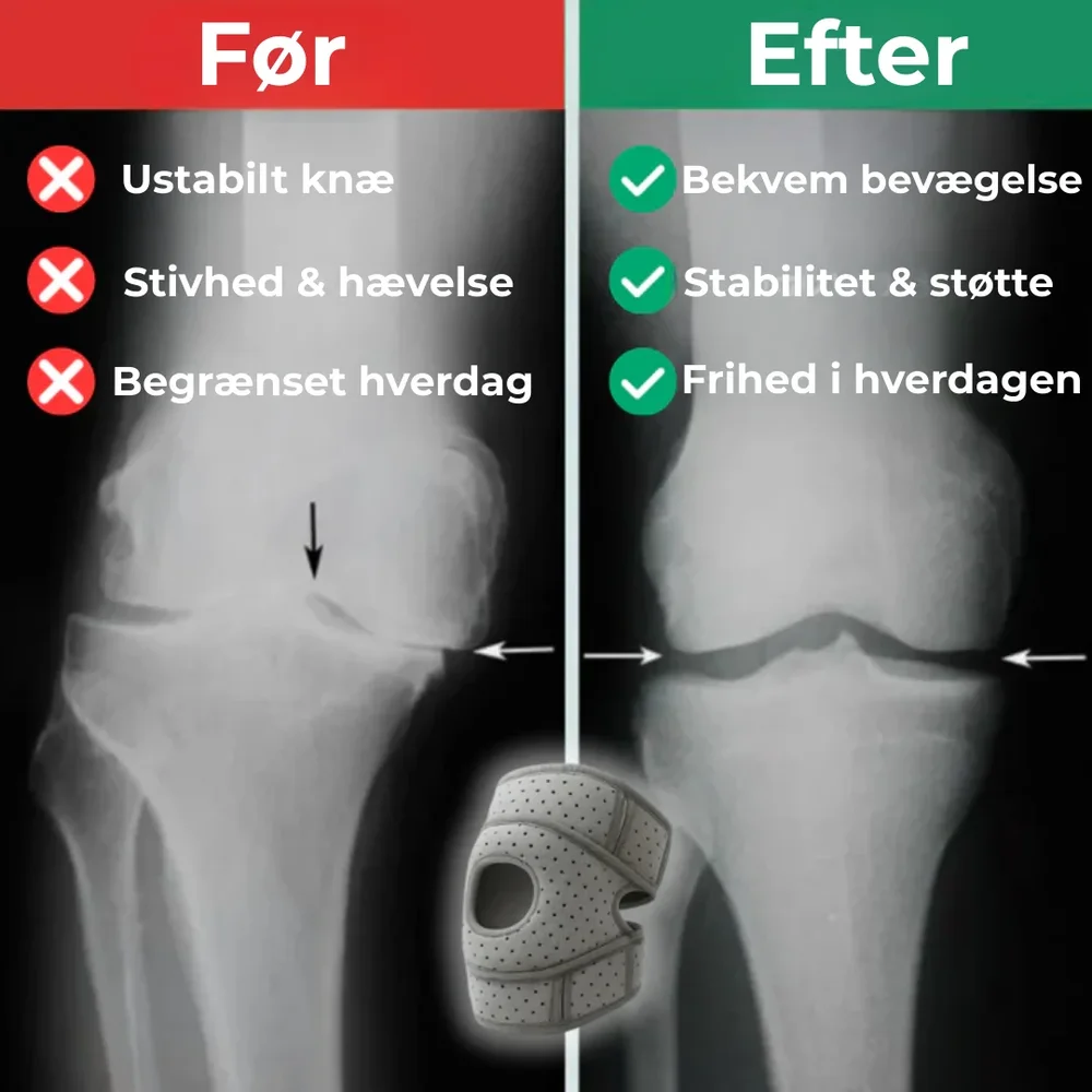KnäStöd Pro® | Säg Hej Då Till Knäsmärtor – Återfå Din Vardag - Bild 3