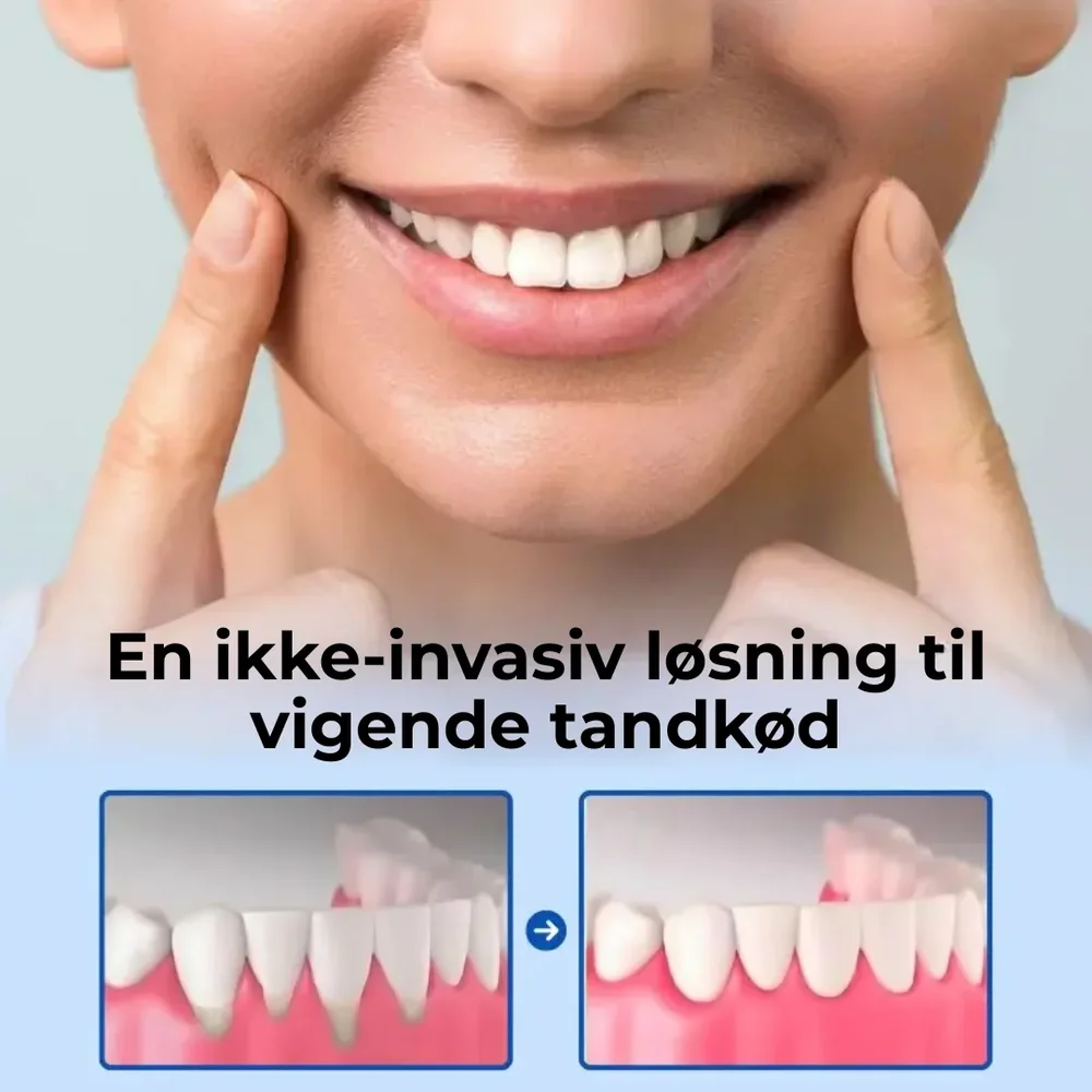 TandRo® | Stoppa tandköttsretraktion naturligt, smärtfritt och på bara 3 dagar! - Bild 2